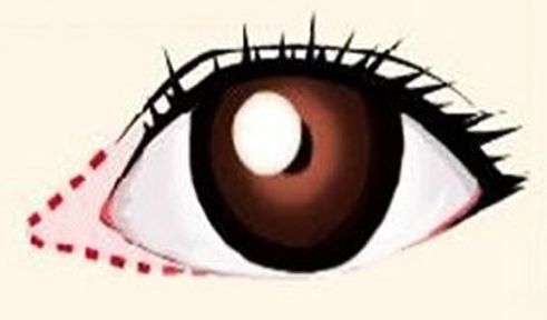 彩光嫩膚祛除紅血絲的效果是否持久？