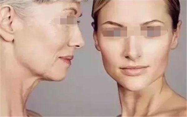 祛除眼袋手術(shù)：告別衰老的有效方法