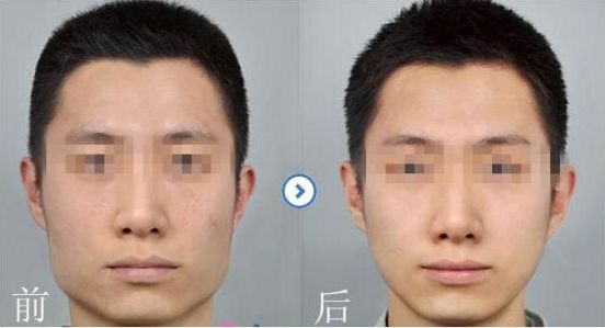 奈瑞兒如何有效減少腰部多余贅肉