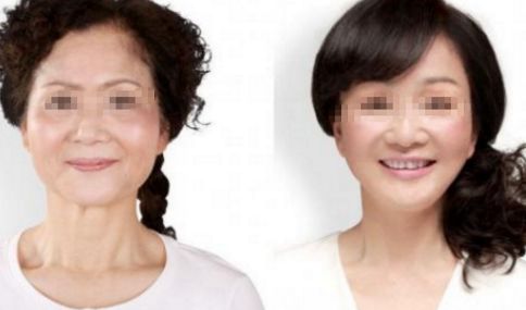 腹部抽脂術(shù)的疼痛感受，了解一下!