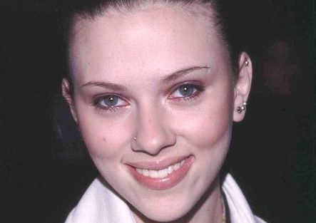 牙齒矯正價格大揭秘！入門價驚喜超預(yù)期，趕緊點開了解吧！