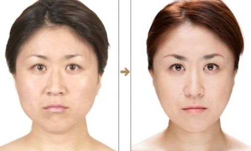 福州愛美爾醫(yī)療美容門診部口碑在線，獨具規(guī)模，享好評！