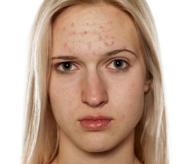 避免隆鼻手術(shù)后遺憾，關(guān)注這些小技巧！