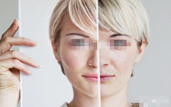 割雙眼皮紋理調(diào)整技巧可改善眼部線條？