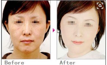 獨(dú)家分享！塌鼻子的完美發(fā)型指南，為你打造精致生活