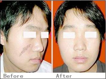 北京鉆石之星醫(yī)療美容真正靠譜嗎？?jī)r(jià)格公道嗎？全面價(jià)格表供您參考！