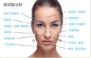 十堰肉毒素注射價(jià)格查詢