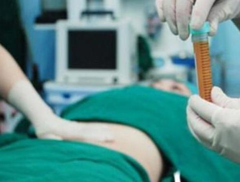 揭秘小眼睛變大神效，眼角拉開(kāi)簡(jiǎn)單方法曝光！