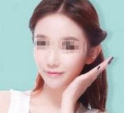 孫儷的容顏變化引發(fā)熱議，她真的進行了整容嗎？