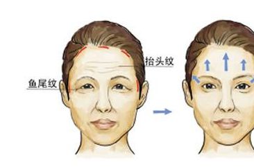 胸部整形費用不同？這些因素竟會影響價格