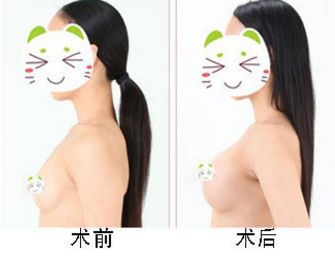 雙美膠原蛋白的種類及其功效和作用全面解析