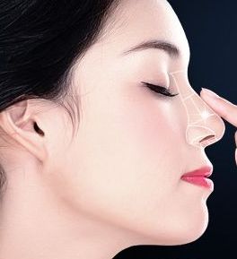 蘭州親民市唇部隆鼻打玻尿酸的價格如何？