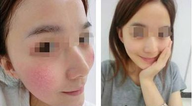 早晨發(fā)現(xiàn)眼袋應(yīng)該怎么解決？5個小方法幫您輕松消除