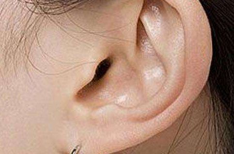 曼托隆胸效果維持時間有限？手術(shù)要注意哪些事項和護理要點必須掌握！