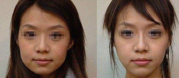 長期外眼角傷害視力？這樣保護(hù)眼睛更有效！