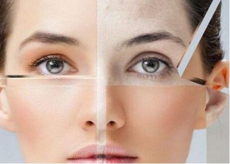 影響吸脂提臀術(shù)價格的關(guān)鍵因素