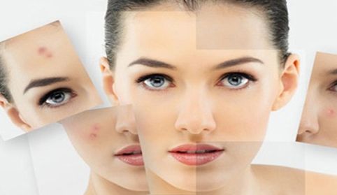 玻尿酸輪廓固定技巧解析：持久年輕面龐效果揭秘！