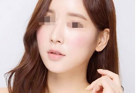 下頜角切除手術(shù)的注意事項(xiàng)及恢復(fù)方法