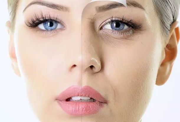 果酸嫩膚后的護(hù)理要點(diǎn)，讓你的肌膚更加細(xì)膩光滑