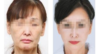 瘦腰攻略大揭秘！豐富有效的減脂方法總結