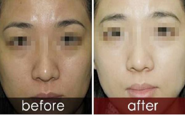 曬黑后如何迅速變白？曬黑美白需要持續(xù)護(hù)理多久結(jié)果可見？了解曬后護(hù)膚科普！