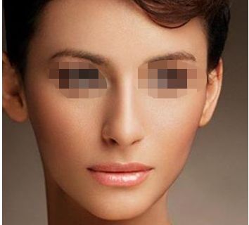 幼態(tài)臉緊致效果揭秘！填充劑真的消腫及維持時(shí)長(zhǎng)有保障嗎？整容前必讀！