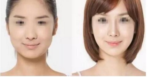 ?？靠噹Т蛟祆n麗顏值  面部提升不再繁復(fù)