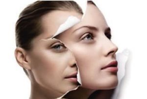 雙下巴吸脂手術(shù)的風(fēng)險下降了嗎