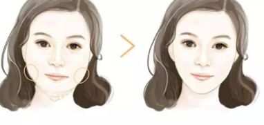 如何解決隆鼻手術(shù)失敗后的肋軟骨修復(fù)方法