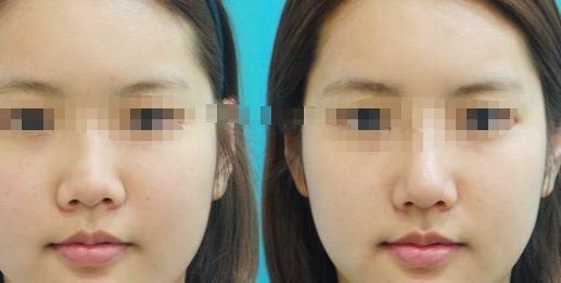 紀(jì)輝私人制造設(shè)備，安全可靠嗎？