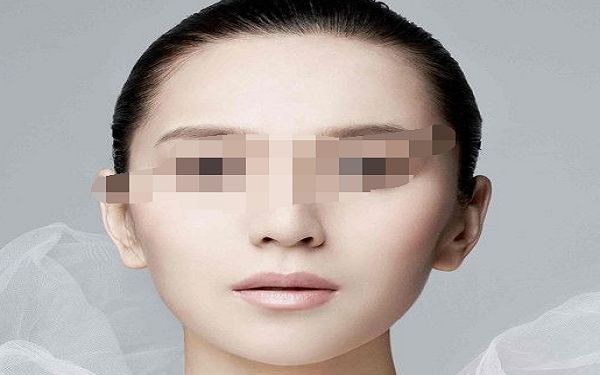 雙眼皮修復(fù)技術(shù) 解決割雙眼皮不完美的問題