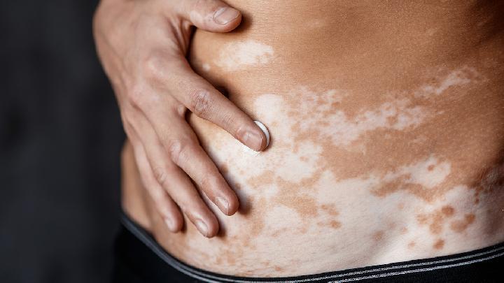 水果神奇美白去斑法，你不得不知道的方法有哪些