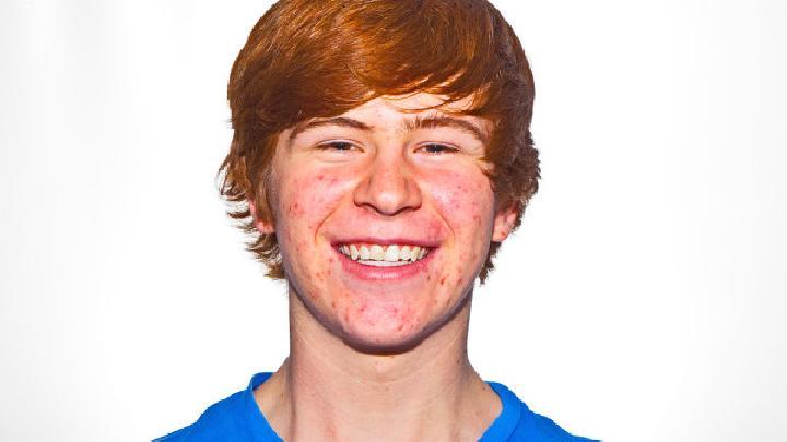 男生青春期祛痘技巧大揭秘！男生祛痘攻略分享！