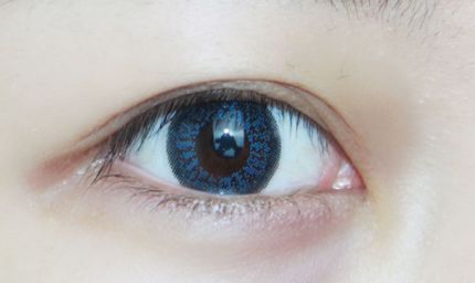 淮南市醫(yī)院有做雙眼皮手術(shù)嗎？手術(shù)技術(shù)如何？價(jià)格如何？實(shí)例解析給您參考