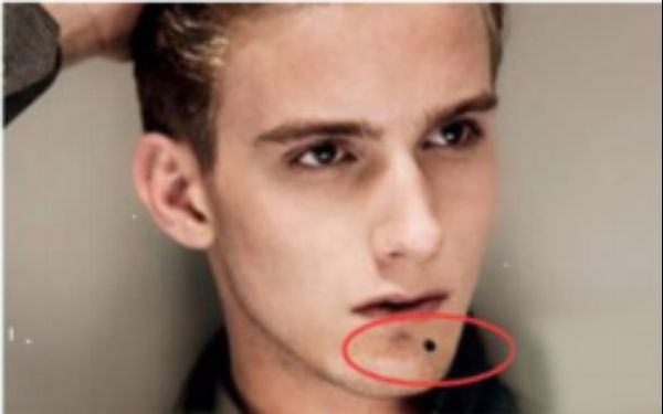 東莞權(quán)威下頜角整形醫(yī)院盤(pán)點(diǎn)：公立與民間專家坐鎮(zhèn)