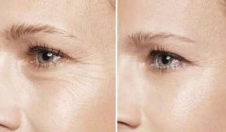 杭州哪家激光祛斑醫(yī)院靠譜？網(wǎng)友強推前五實力醫(yī)院