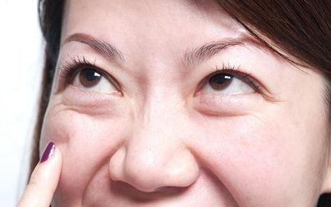 上海九院去眼袋專家推薦，最全擅長(zhǎng)項(xiàng)目及費(fèi)用一覽