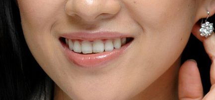 探尋西安藝星宋蔚雙眼皮技術(shù)，深度解析醫(yī)生實力與經(jīng)典案例分享