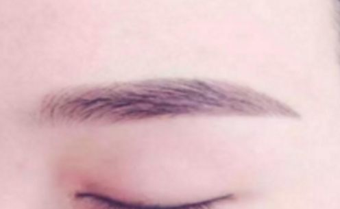 長(zhǎng)沙最受歡迎的植發(fā)整形醫(yī)院推薦