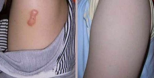 天津河?xùn)|美萊醫(yī)學(xué)醫(yī)院受推崇的全雙醫(yī)生吸脂術(shù)是否靠譜？