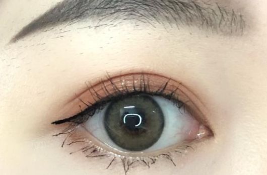 深圳保麗圣瑞整形醫(yī)院面部脂肪填充2023案例分享，效果好嗎？