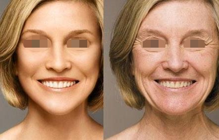 2024湖南正頜手術哪里做的好