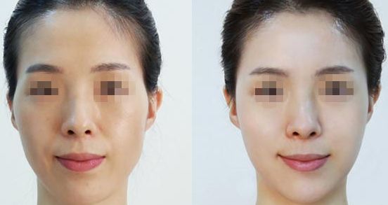 南寧亞太整形醫(yī)院：專家云集，口碑相傳