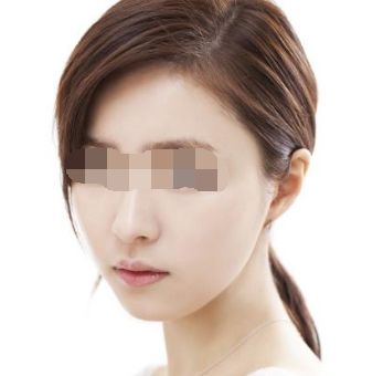 株洲有哪些優(yōu)秀整形醫(yī)院值得關注？