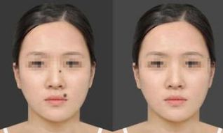 天津疤痕修復(fù)名院盤點(diǎn)：醫(yī)大總院、南開醫(yī)院、美萊位列前茅