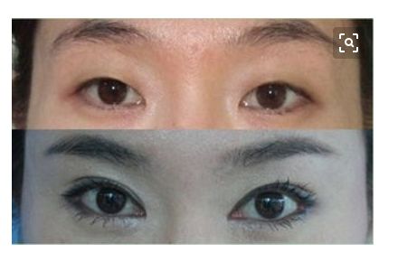 北京三家醫(yī)療整形醫(yī)院推薦