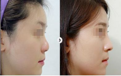 2024年度中國整容醫(yī)院匯總：最佳五家醫(yī)療機構揭曉