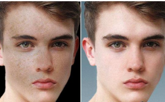 2024中國(guó)假體隆胸權(quán)威醫(yī)院指南：上海、北京、廣州、武漢