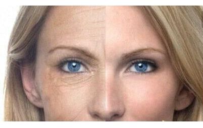 上海華美謝衛(wèi)國醫(yī)生：隆鼻案例驚艷，塑造完美鼻型效果太真實