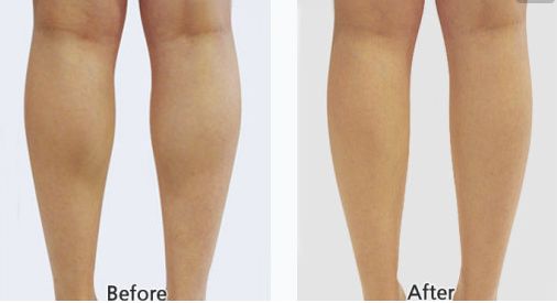 射頻緊膚整形醫(yī)院排行榜，專家推薦的三家一流醫(yī)院震撼上榜